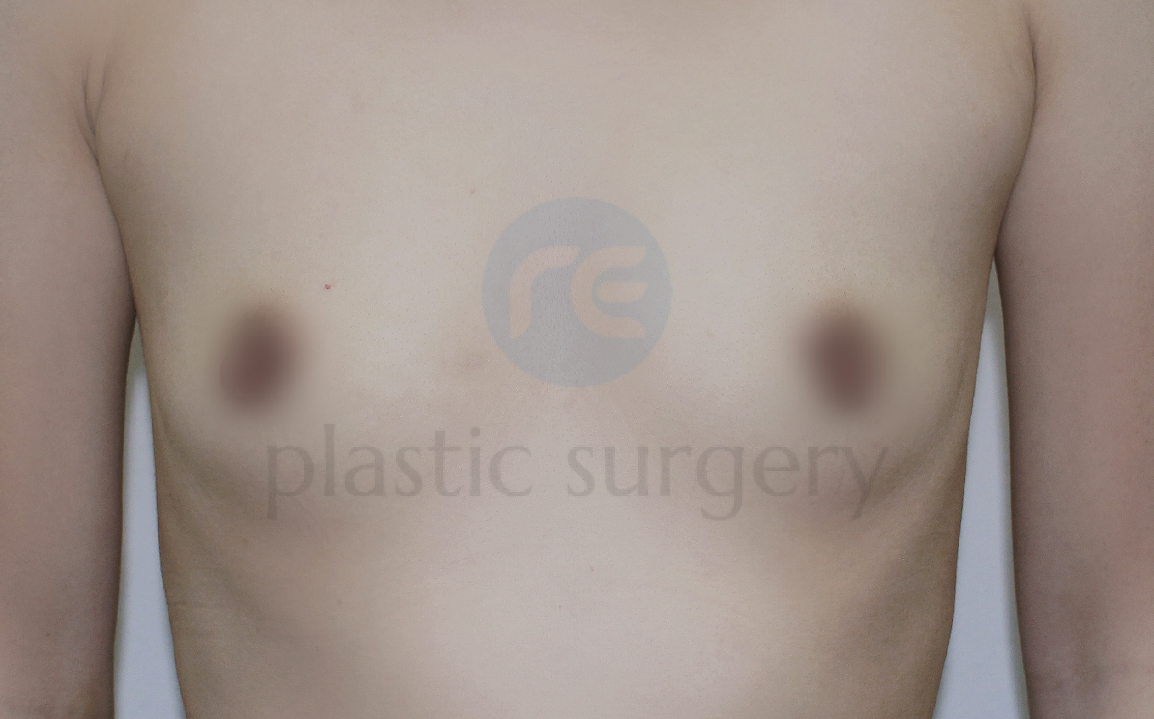 Before image