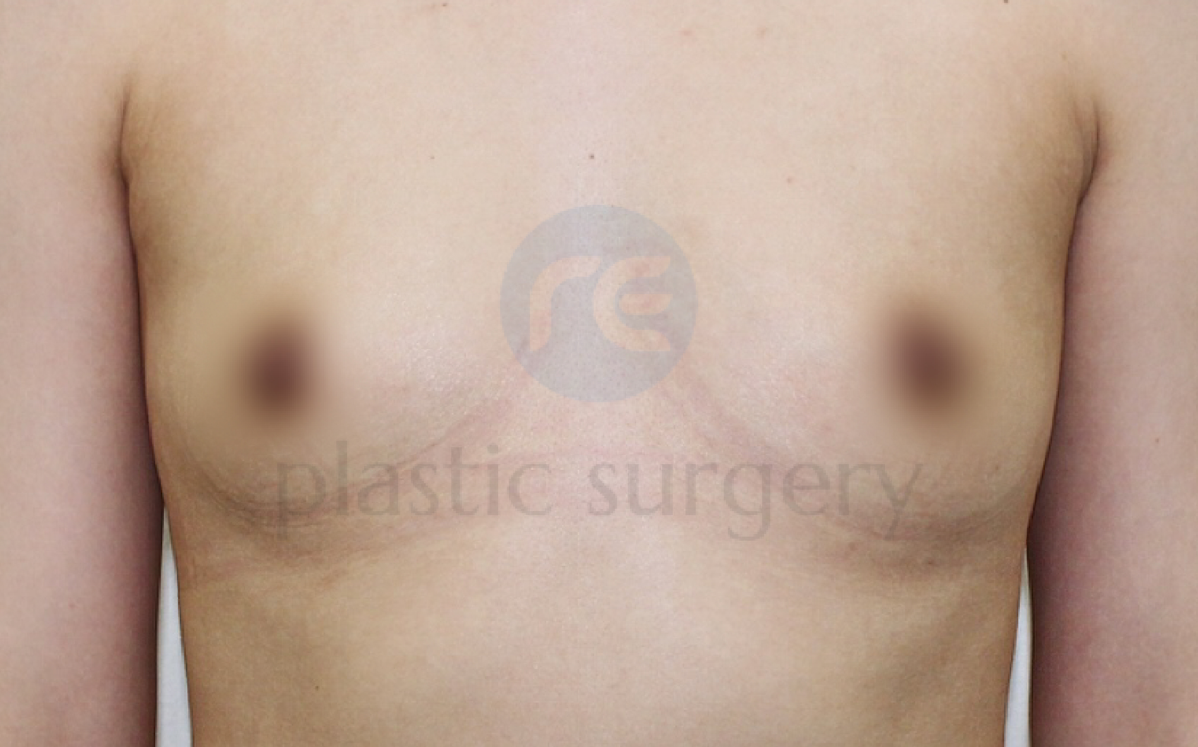 Before image