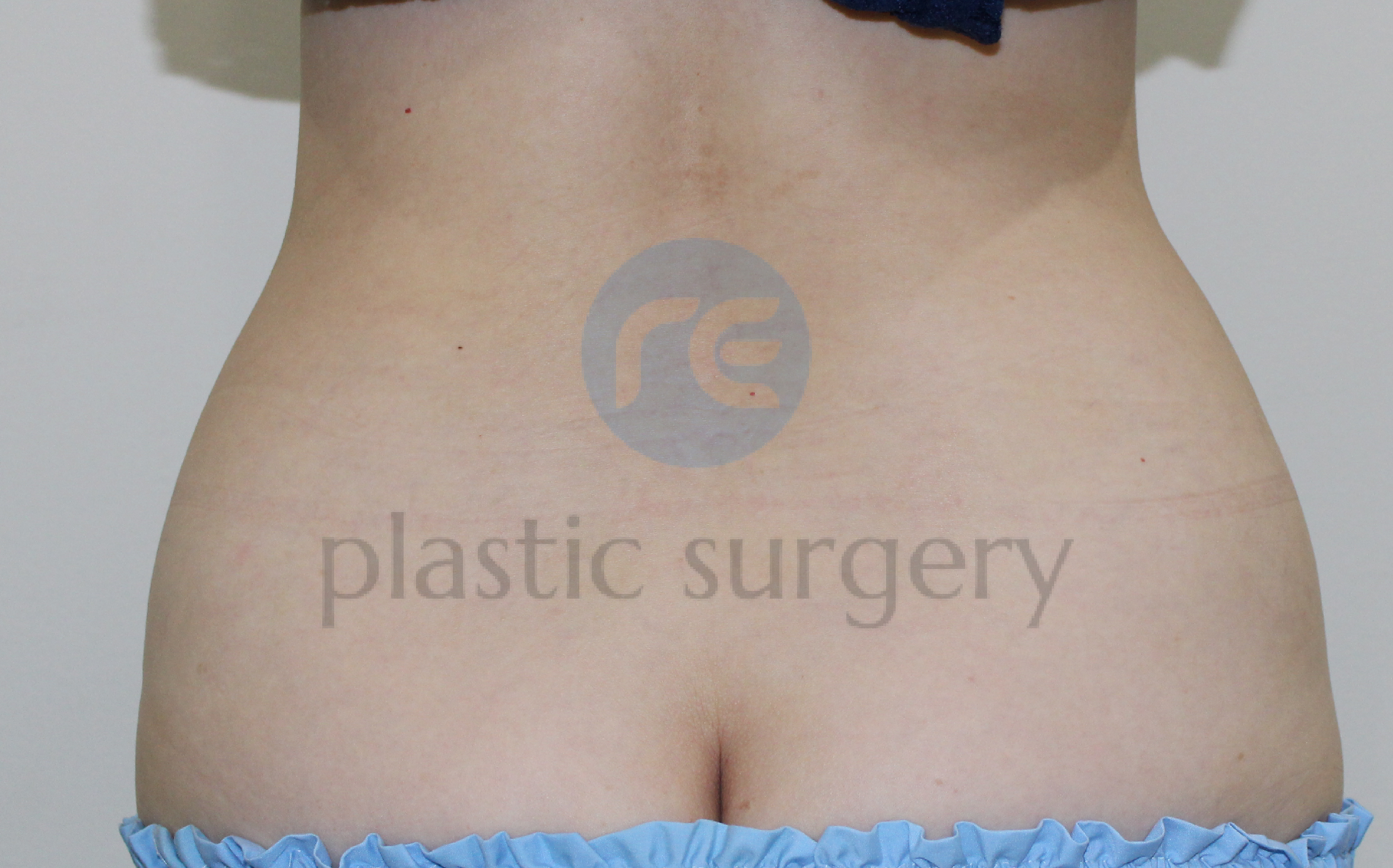After image