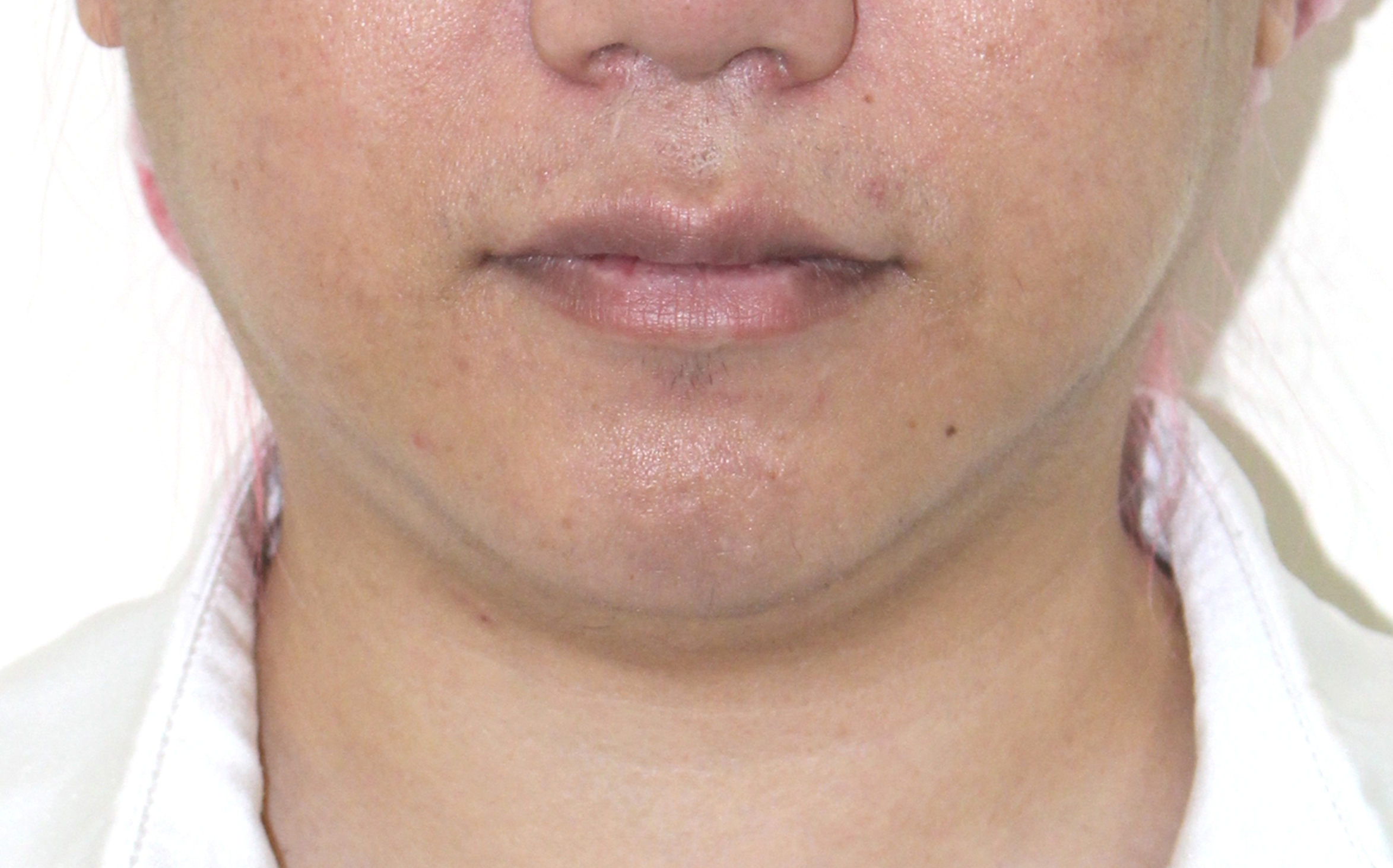 Before image