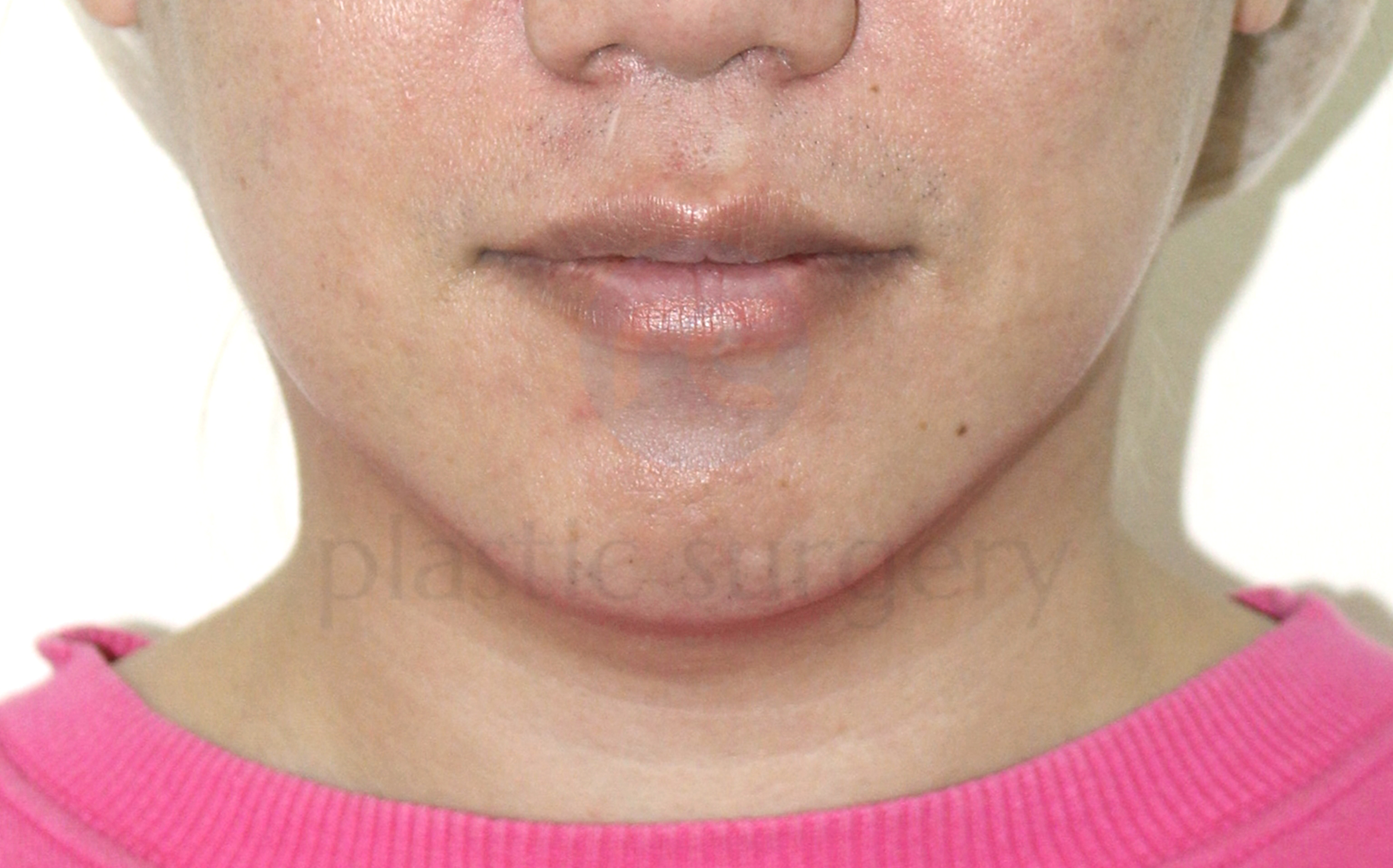 After image