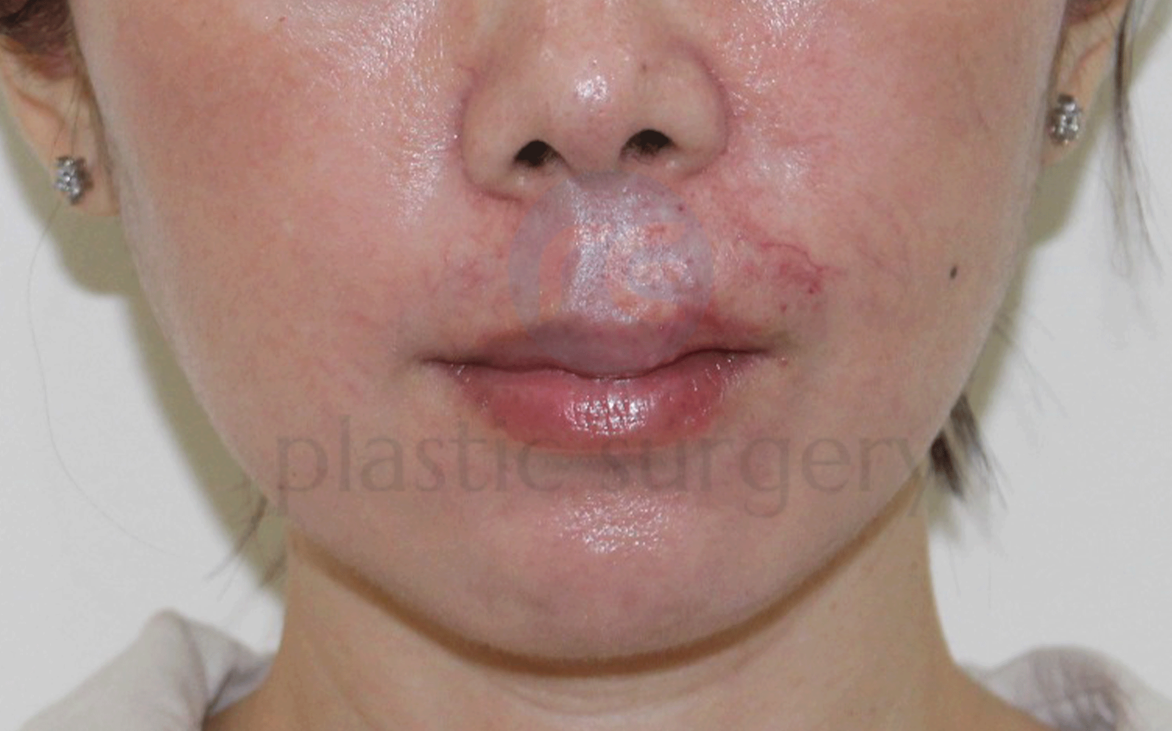 After image