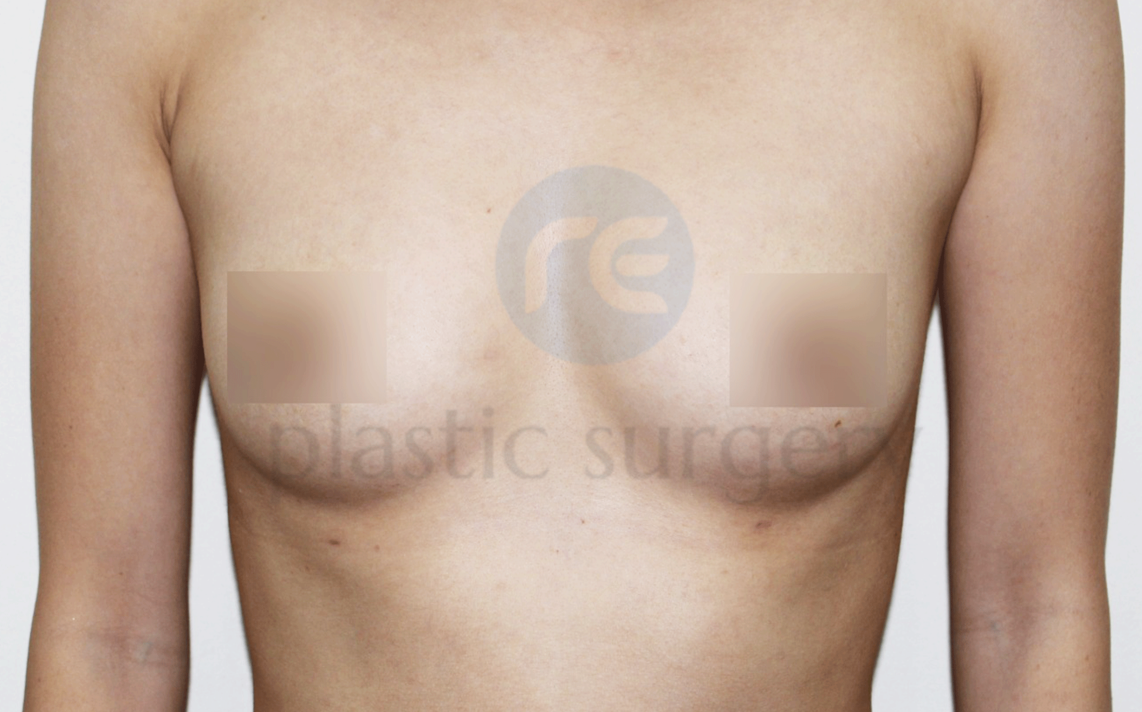 After image