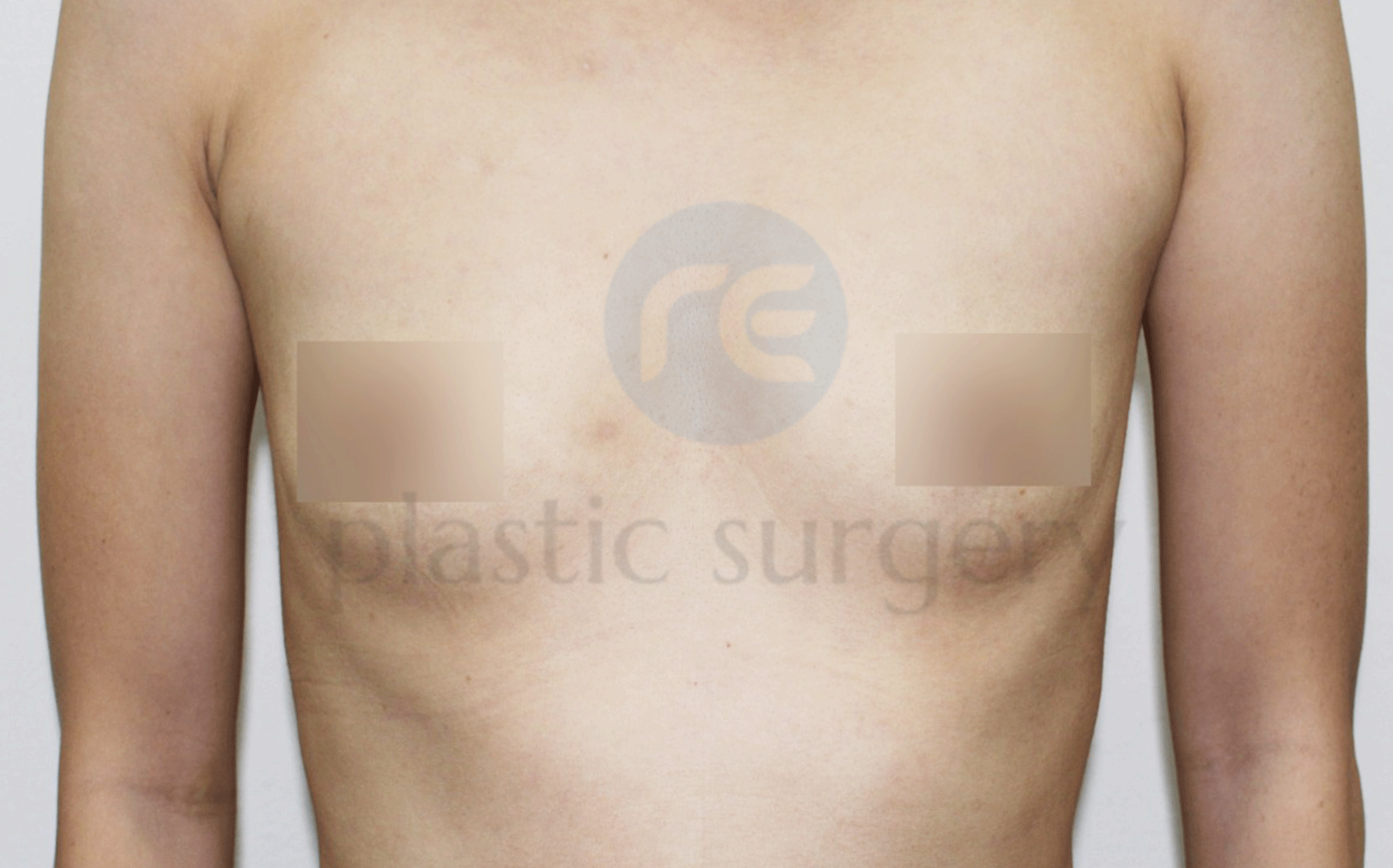 Before image