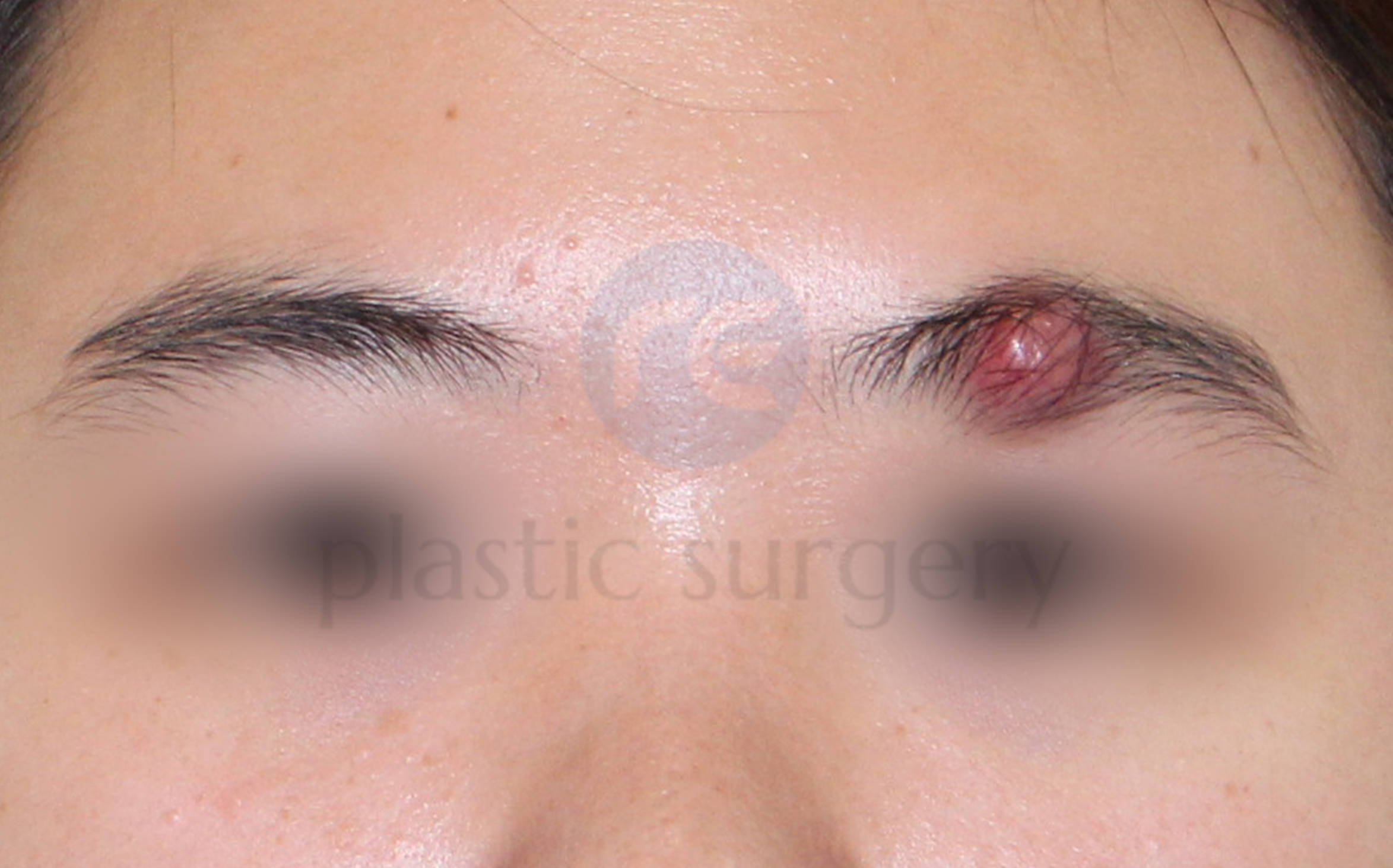 Before image