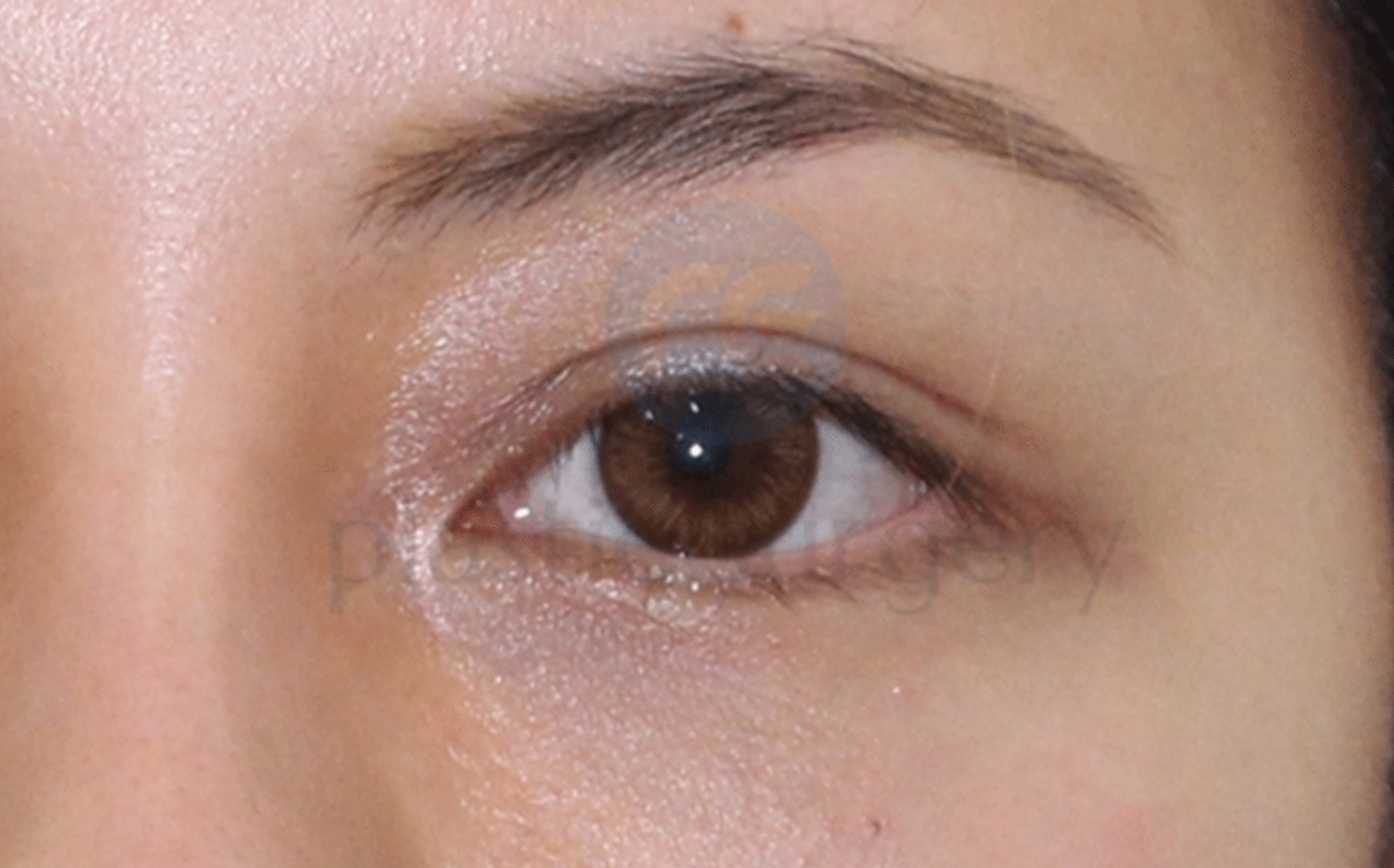 Before image