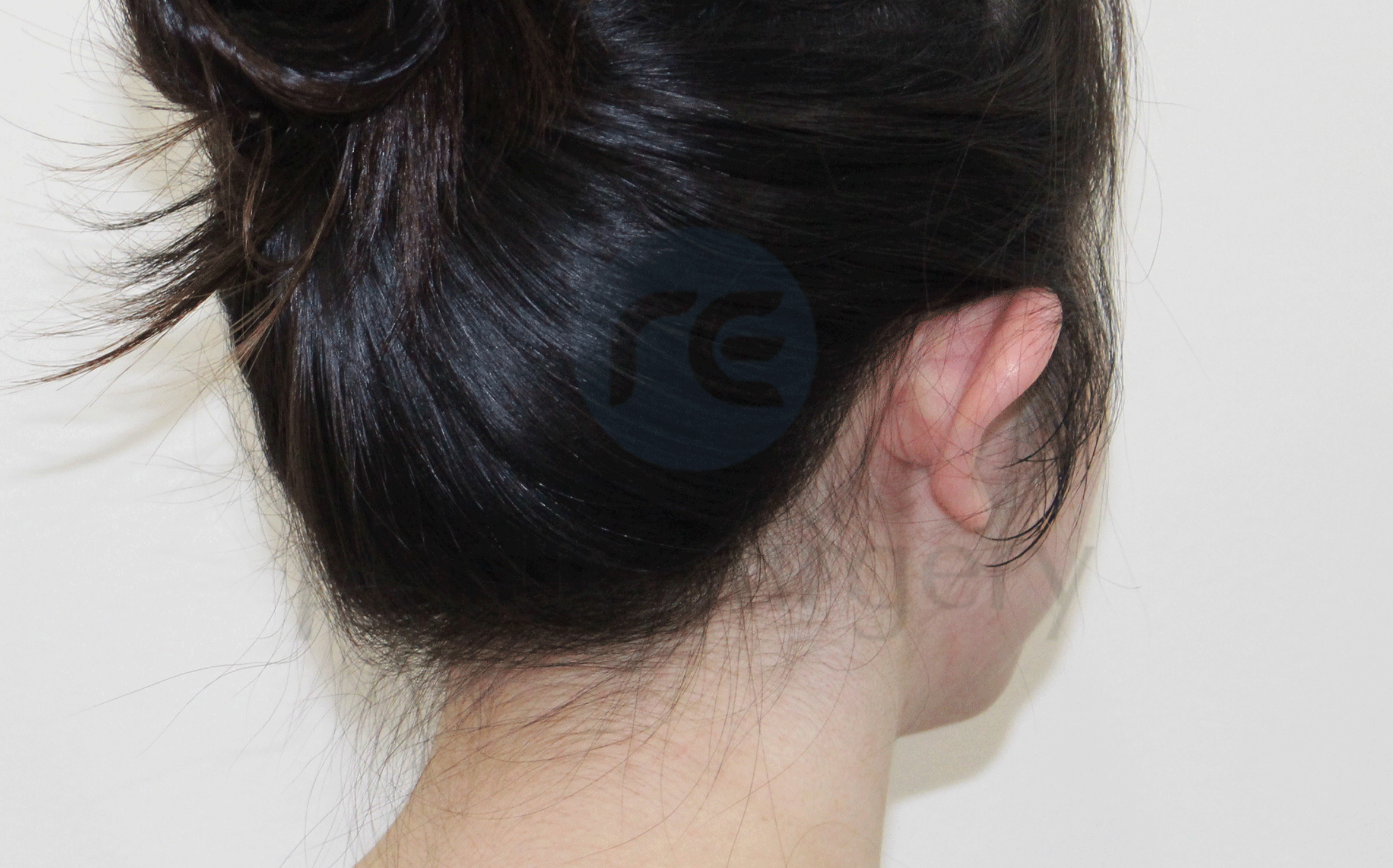 Before image