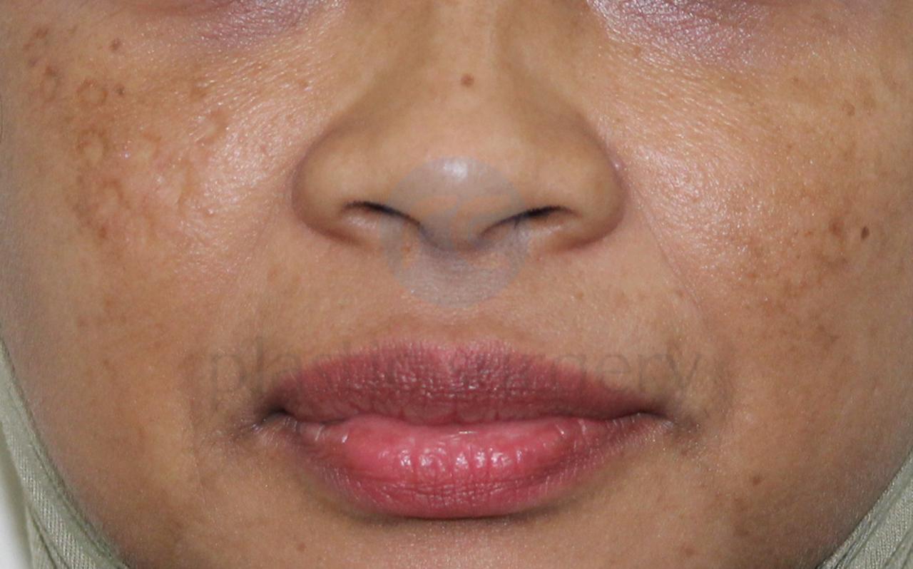 After image