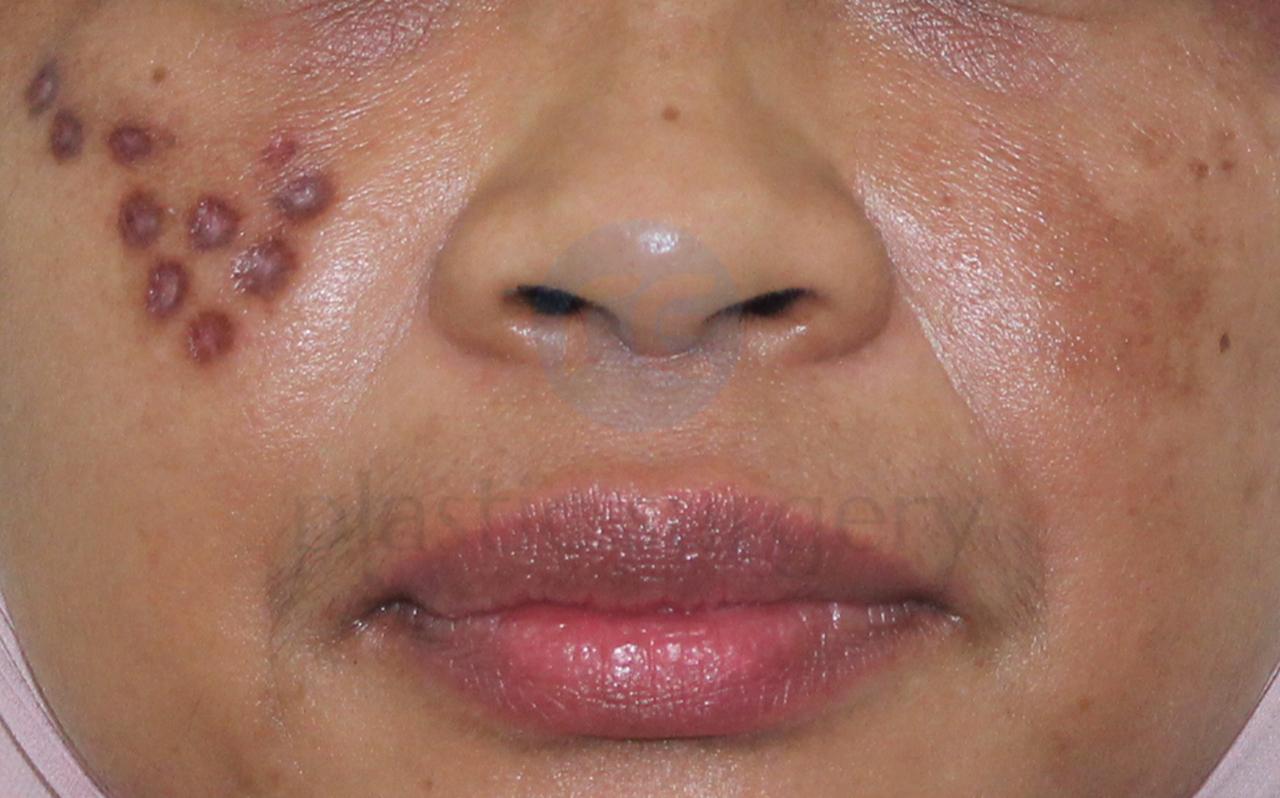 Before image