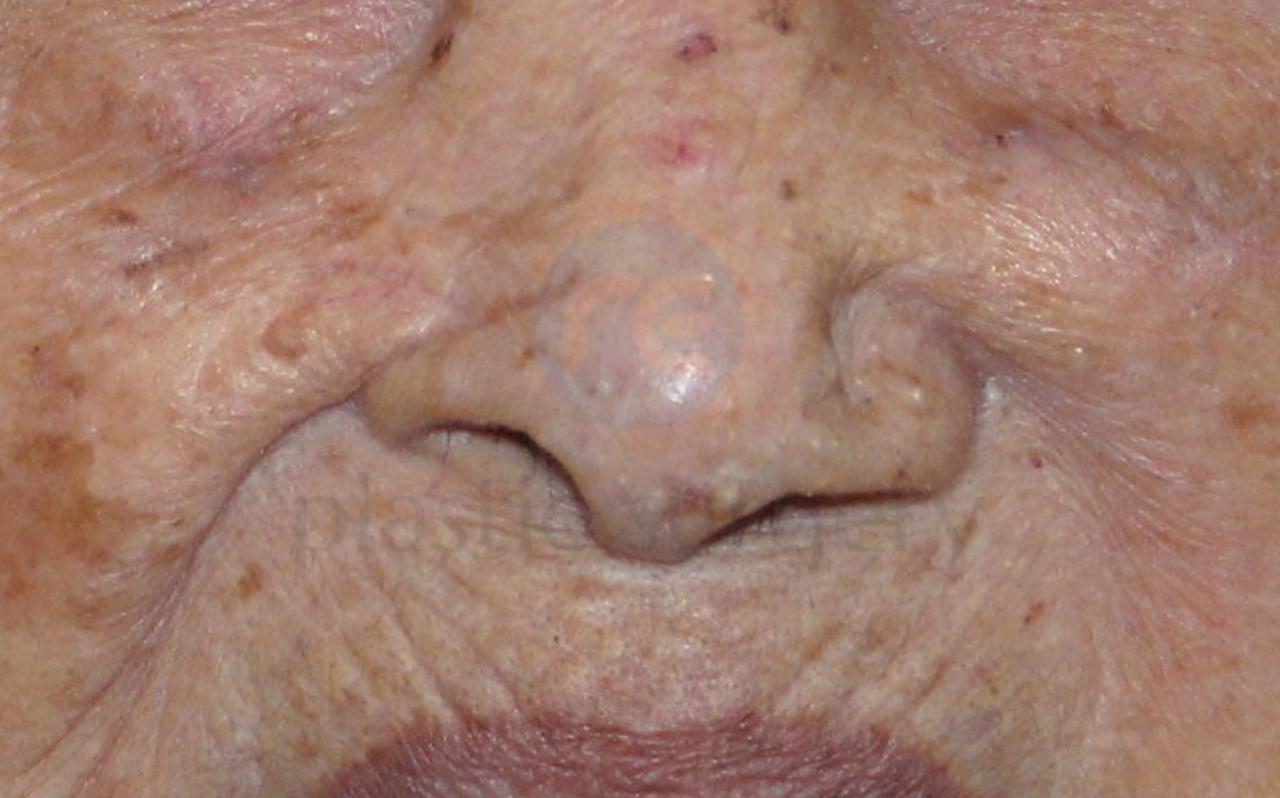 After image