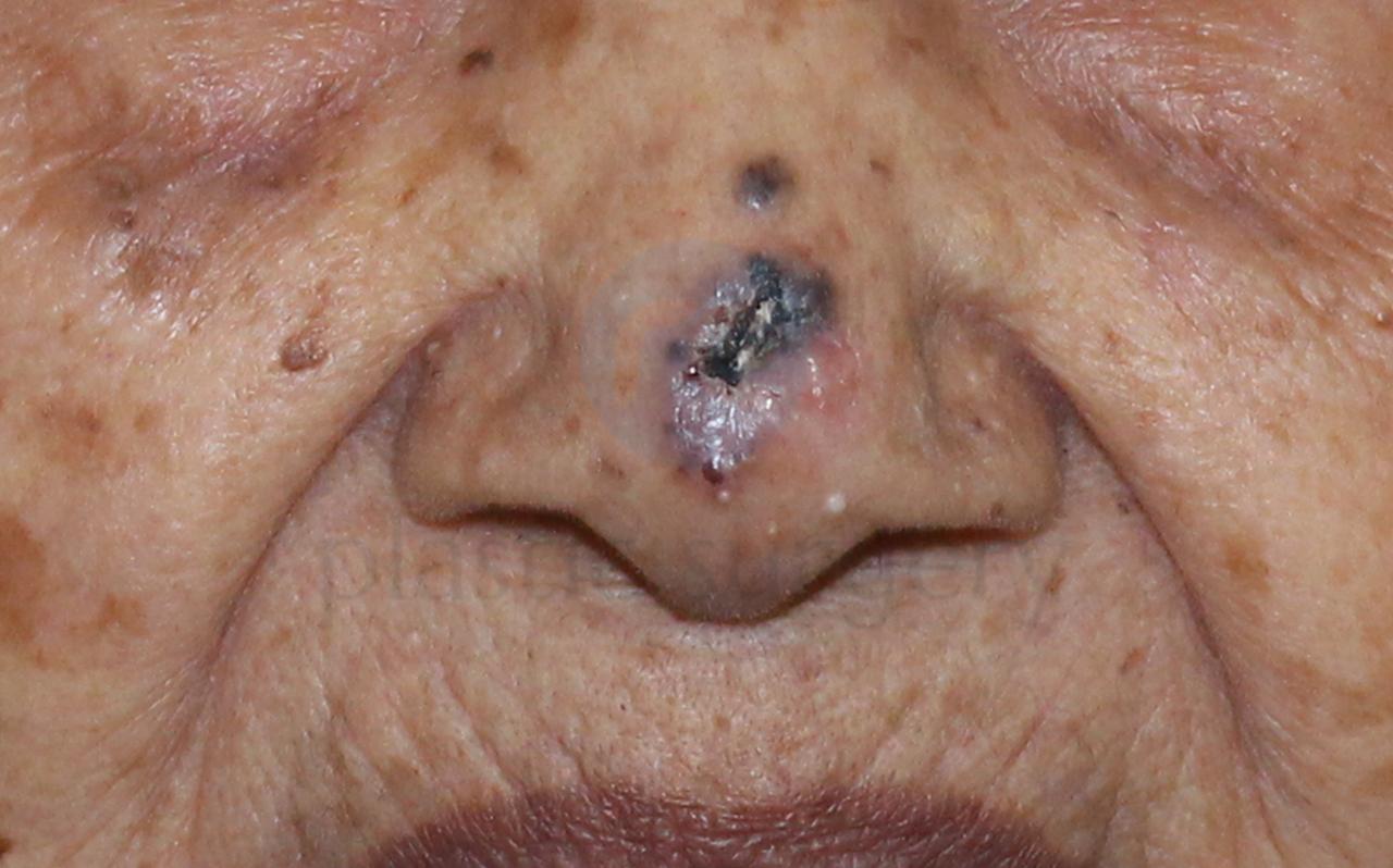 Before image