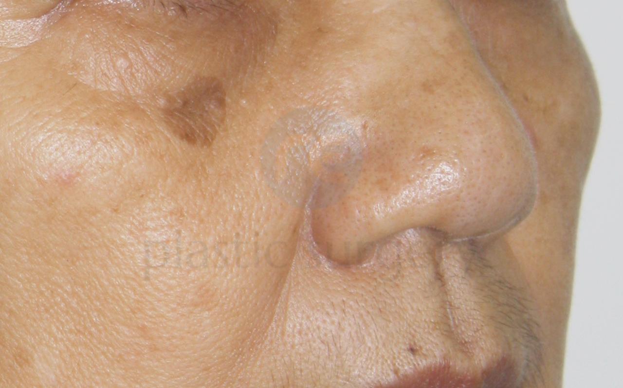 Before image