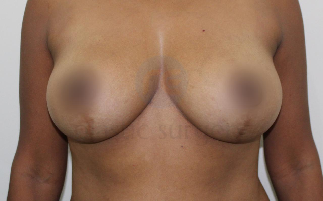 After image