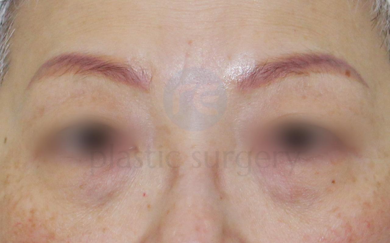 Before image