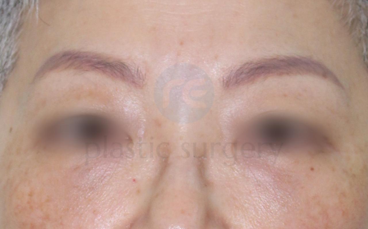 After image