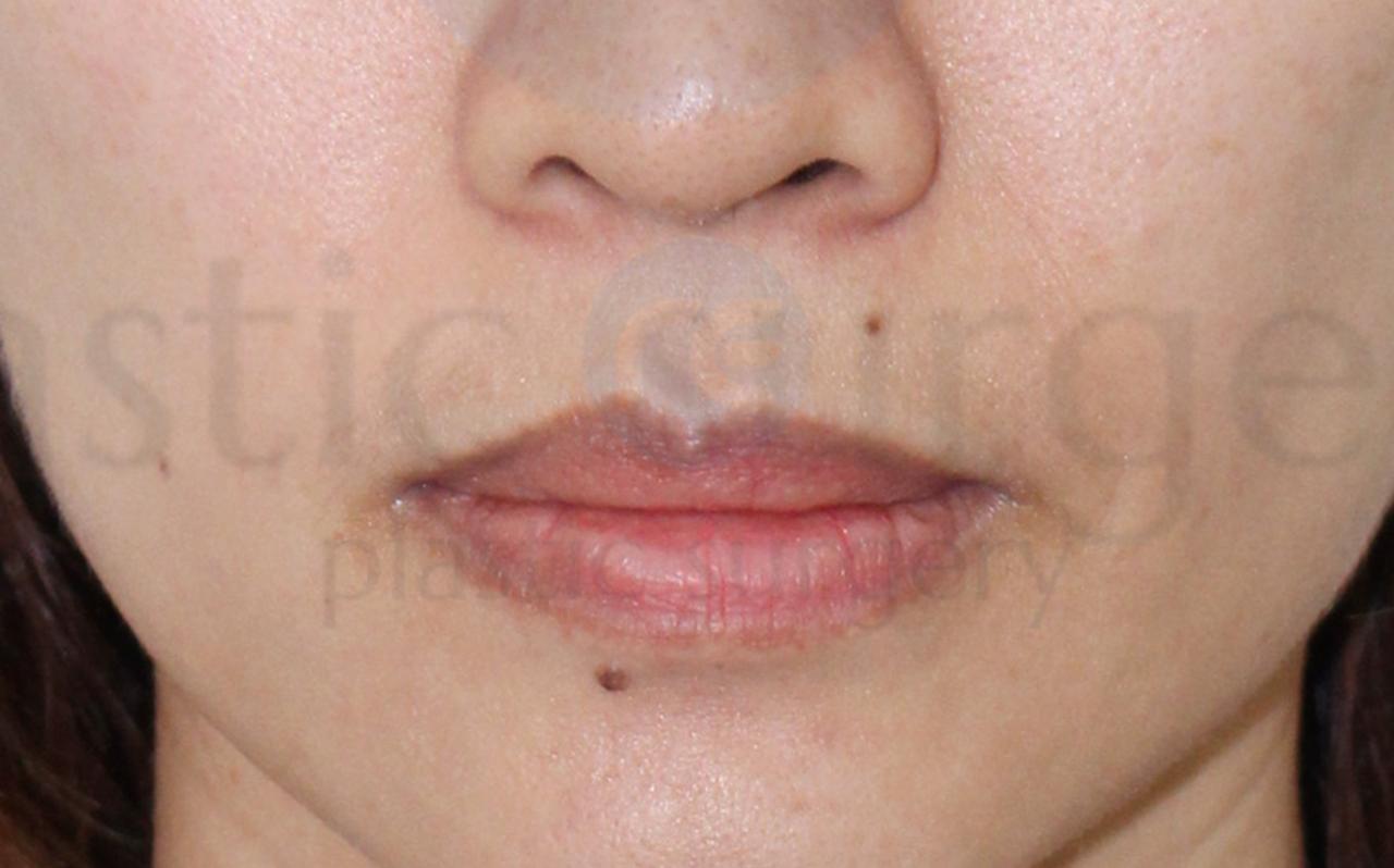 Before image