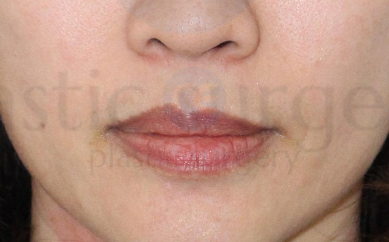 After image