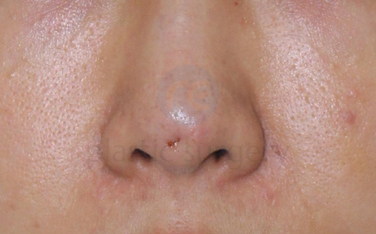 Before image