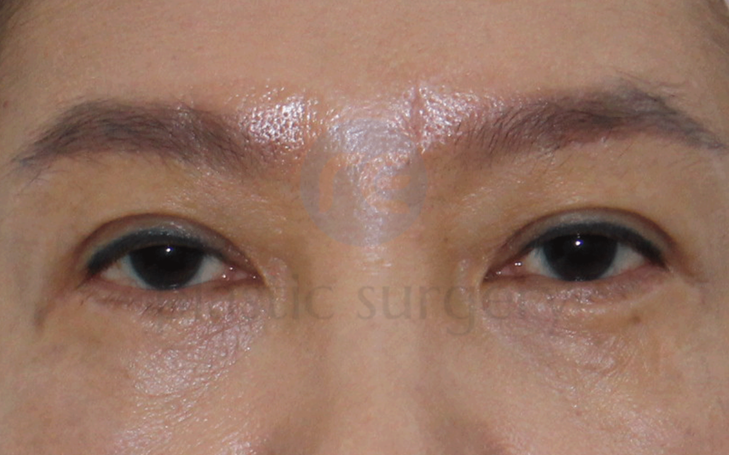 After image