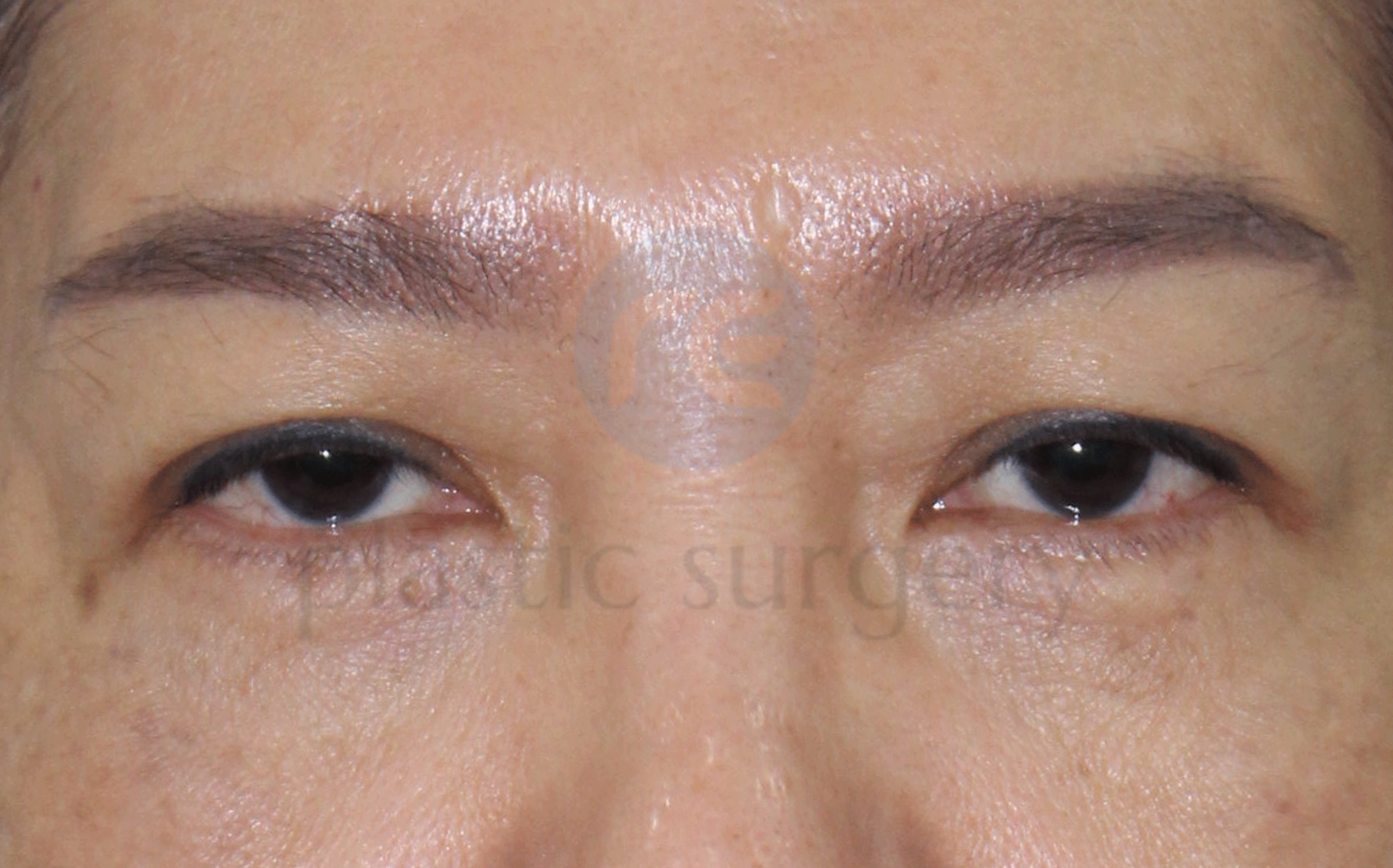 Before image