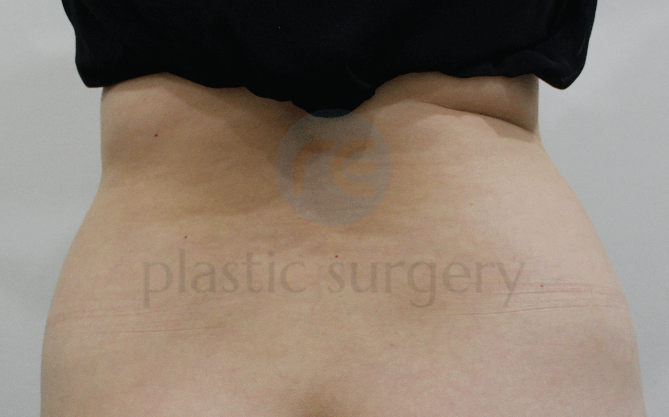 Before image